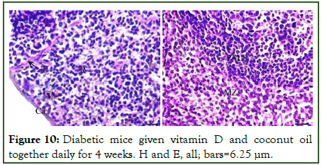 Microbial-Biochemical-Diabetic