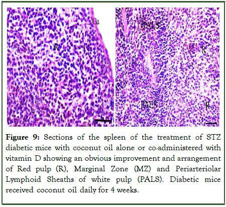 Microbial-Biochemical-Lymphoid