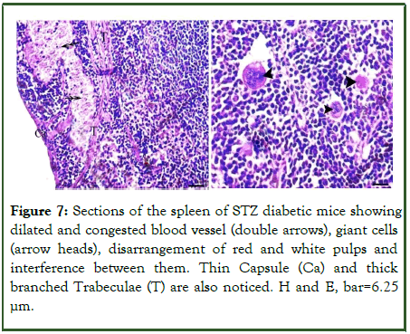 Microbial-Biochemical-congested