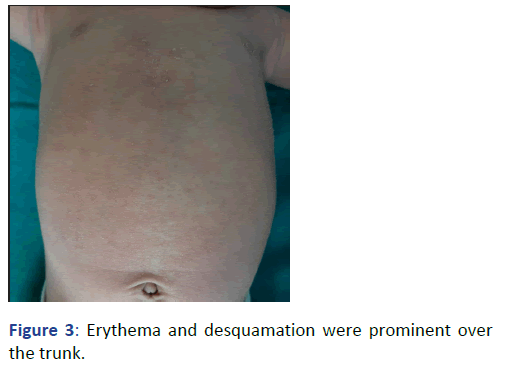 Pediatric-Dermatology-Erythema