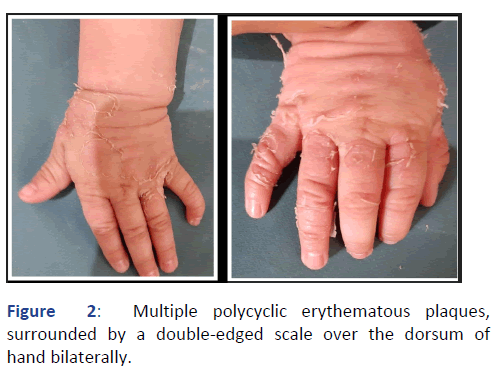 Pediatric-Dermatology-polycyclic