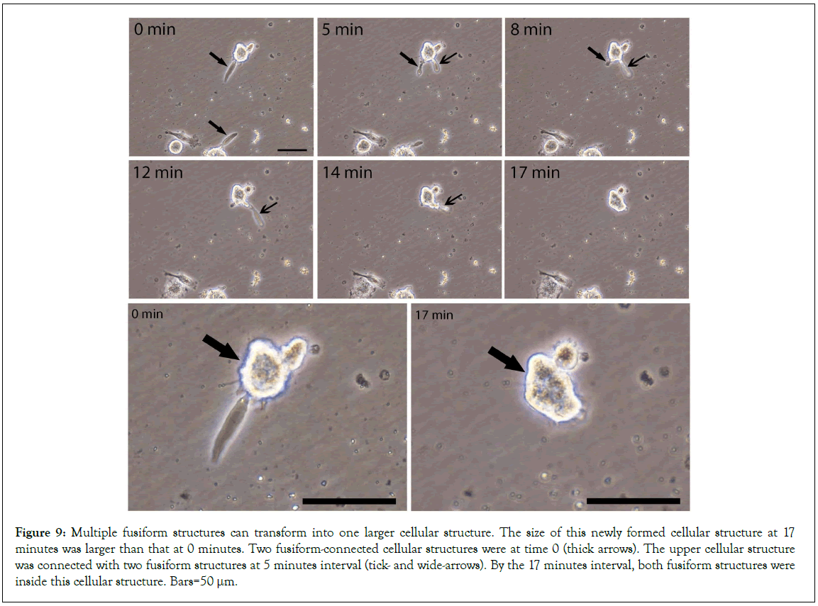 Stem-Cell-fusiform