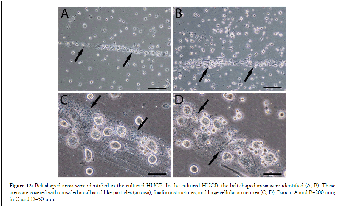 Stem-Cell-fusiform