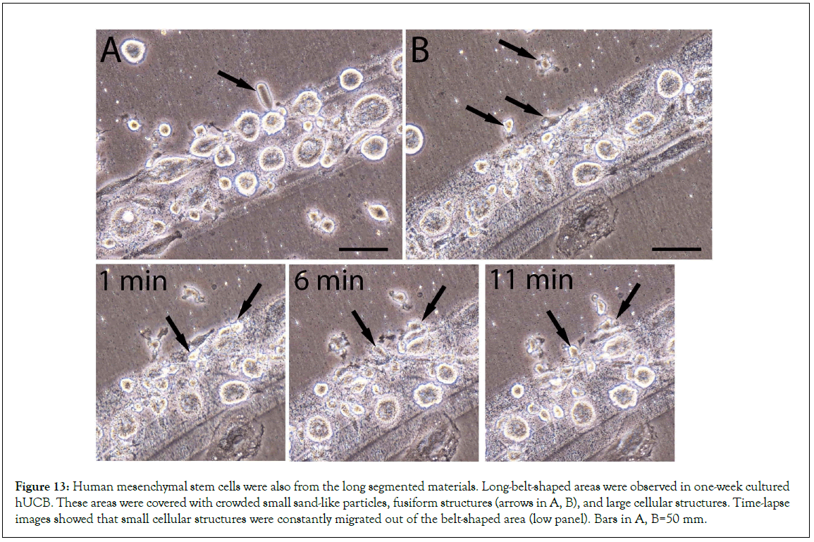 Stem-Cell-mesenchymal