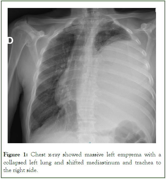 Surgery-massive