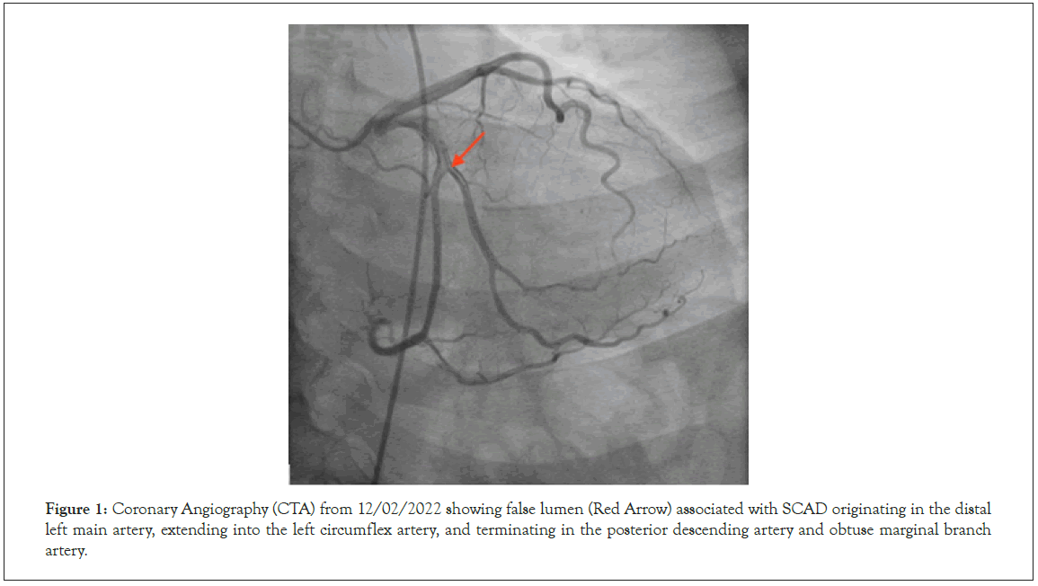 Thrombosis-Circulation-Angiography