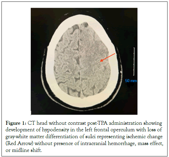 Thrombosis-Circulation-administration