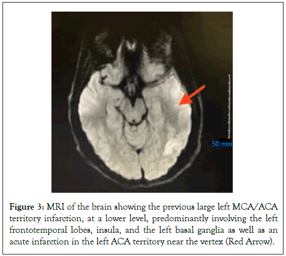 Thrombosis-Circulation-predominantly