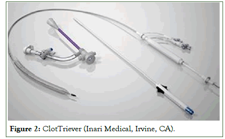 Vascular-Medicine-ClotTriever