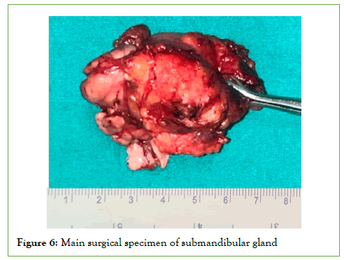 Vascular-Medicine-submandibular