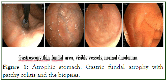 disorders-transfusion-Gastric