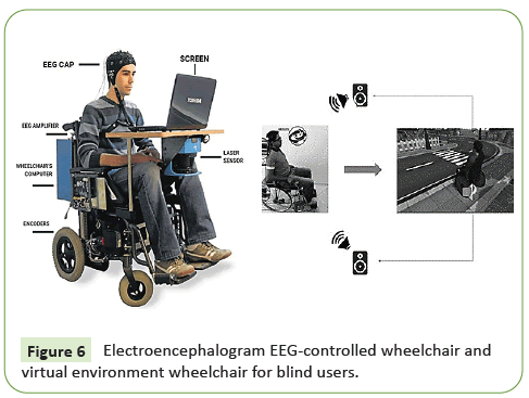 journal-neurology-blind