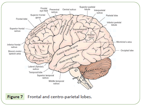 journal-neurology-lobes