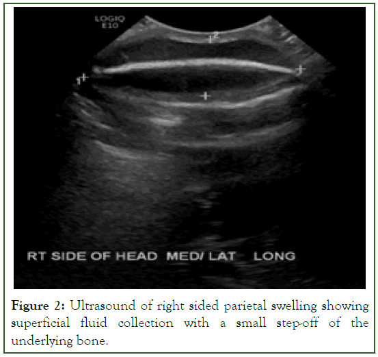 neonatal-biology-Ultrasound
