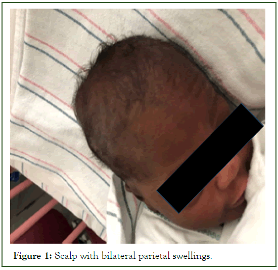 neonatal-biology-swellings