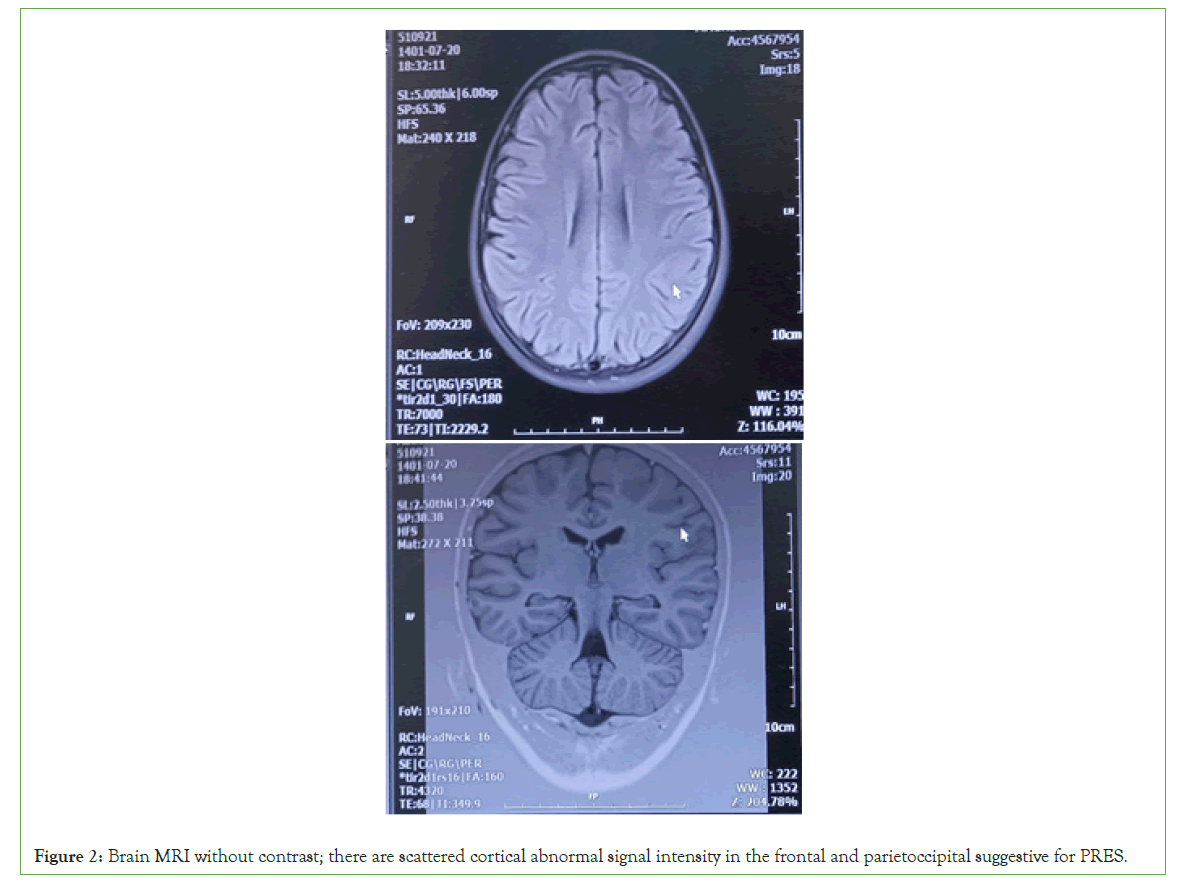 pain-management-corital