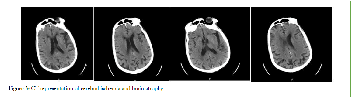 psychiatry-cerebral