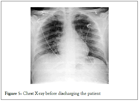 surgery-anesthesia-discharging