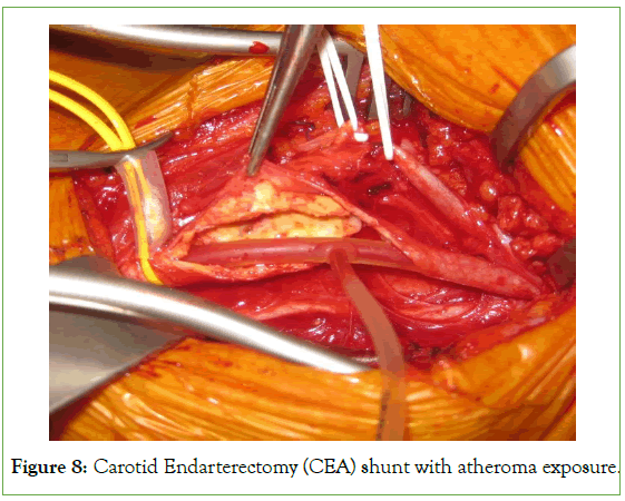 surgery-anesthesia-exposure