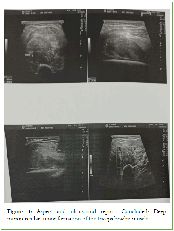 tumour-research-Concluded