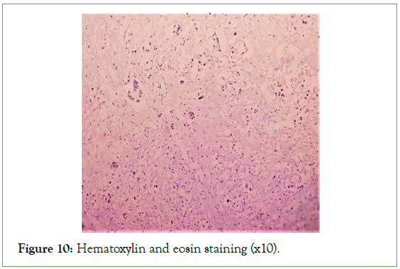 tumour-research-Hematoxylin