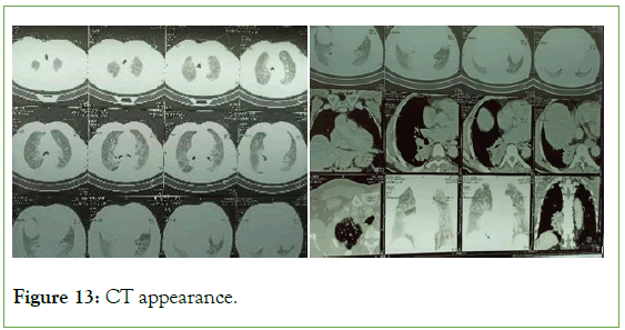 tumour-research-appearance