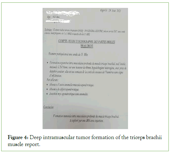 tumour-research-intramuscular