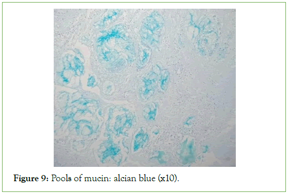 tumour-research-mucin