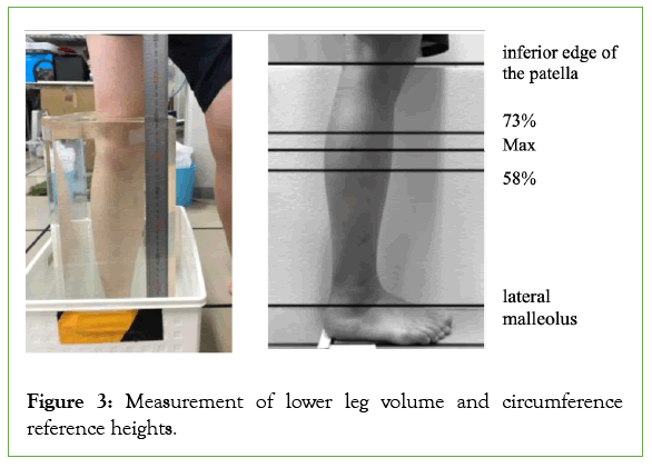 vascular-medicine-lower