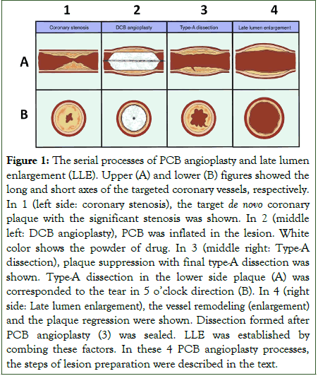 vascular-medicine-surgery-angioplasty