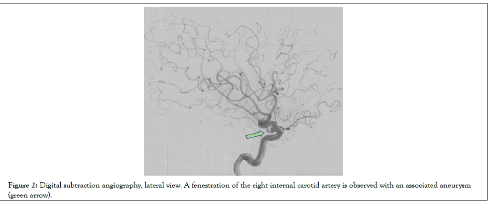 vascular-surgery-anigography