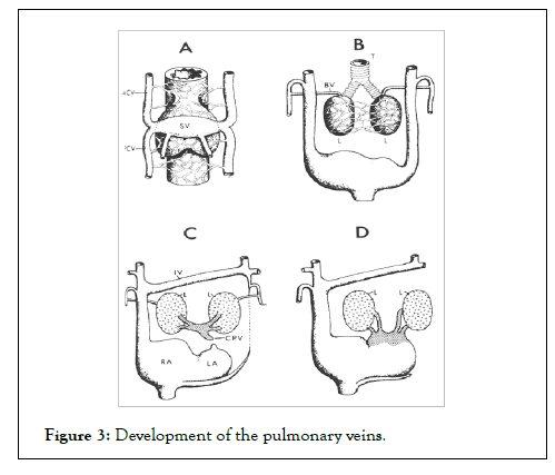 vascular-surgery-develop