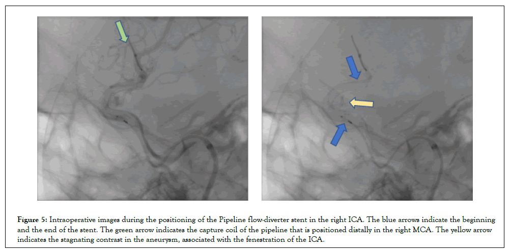 vascular-surgery-green