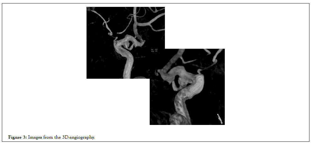 vascular-surgery-lateral