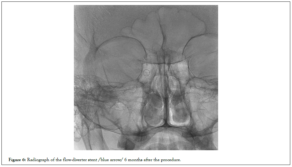 vascular-surgery-radio