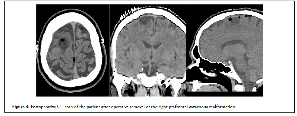 vascular-surgery-right