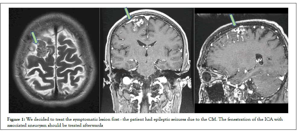 vascular-surgery-treat