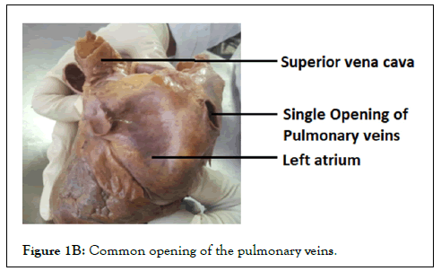 vascular-surgery-veins