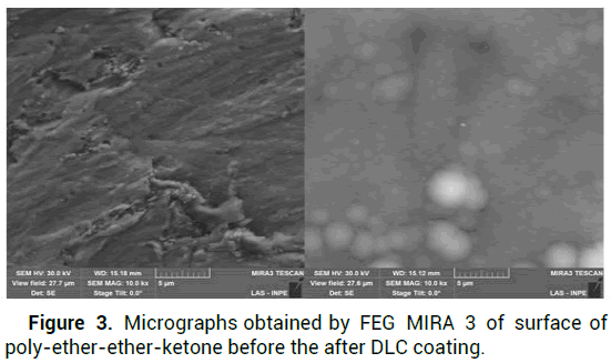 ACR-FEG