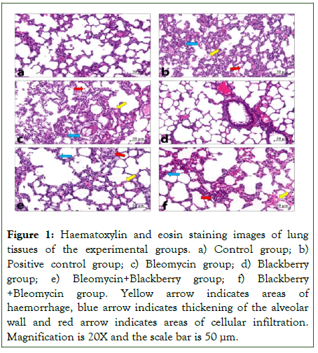 blood-disorders-transfusion-exclusion