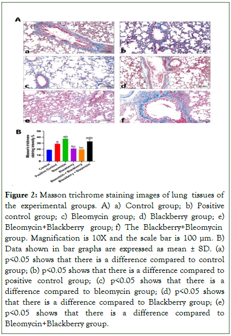 blood-disorders-transfusion-exclusion