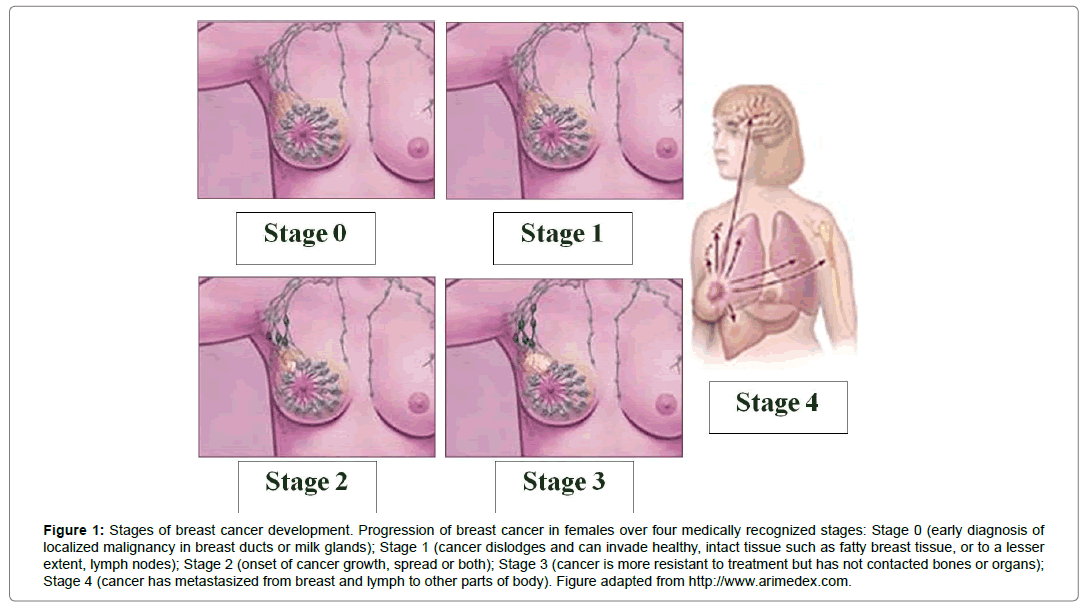 Bioequivalence-Bioavailability-breast-cancer