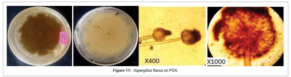 Pathology-Microbiology-Aspergillus