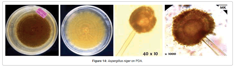 Pathology-Microbiology-Aspergillus