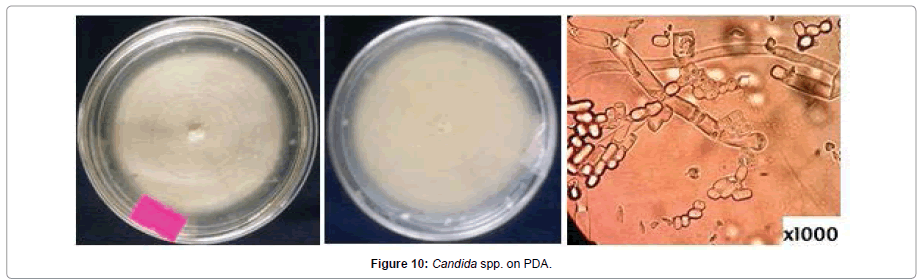 Pathology-Microbiology-Candida