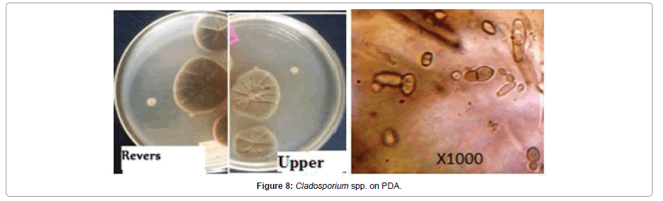 Pathology-Microbiology-Cladosporium