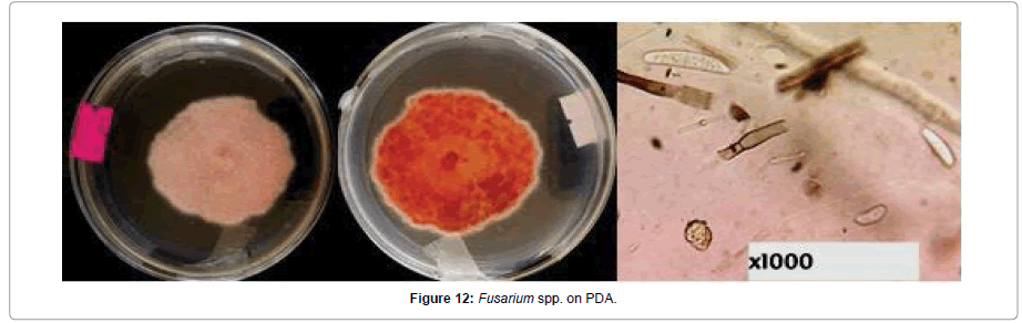 Pathology-Microbiology-Fusarium