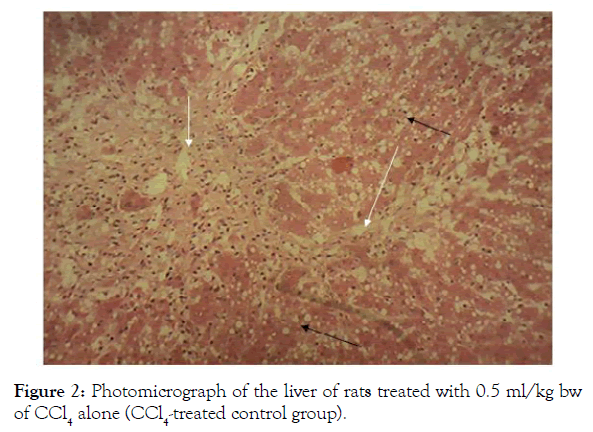 biochemistry-and-analytical-biochemistry-photomicrograph-liver