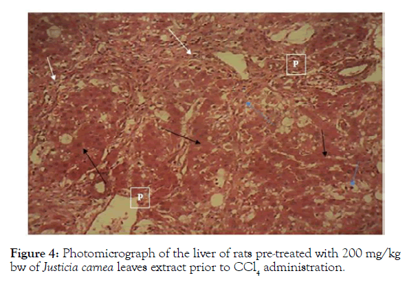 biochemistry-and-analytical-biochemistry-photomicrograph-liver