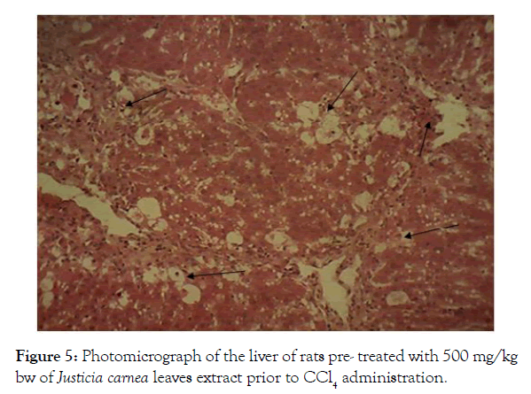 biochemistry-and-analytical-biochemistry-photomicrograph-liver